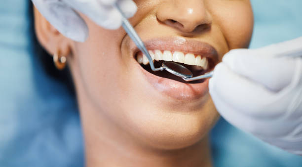 Best Emergency Dental Care for Broken or Chipped Teeth in Spokane Valley, WA